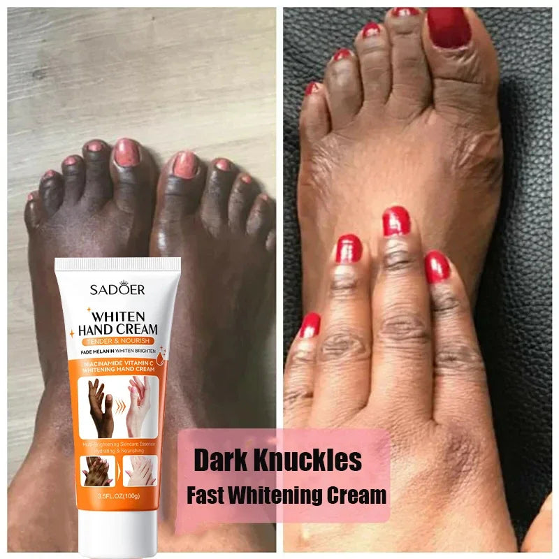 Dark Knuckles Fast Whitening Serum Anti Cracking Cream Pigmentation Correctors For Black Skin Intense Stains Remover Products